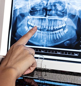 Dentist reviewing X-ray on screen