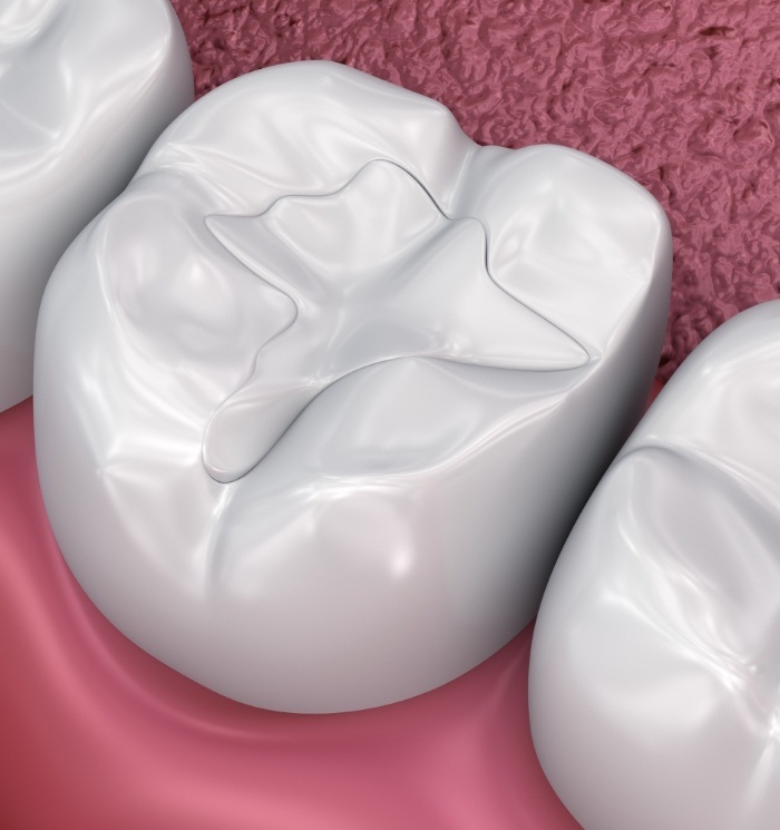 Animated row of teeth with dental sealants