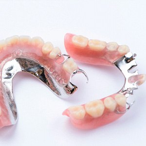 Partial dentures on a table